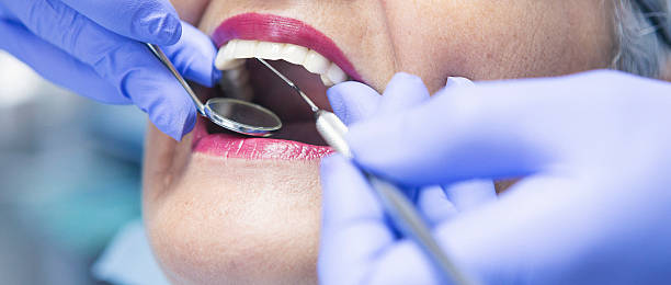 Best Dentist for Tooth Abscess  in Bicknell, IN
